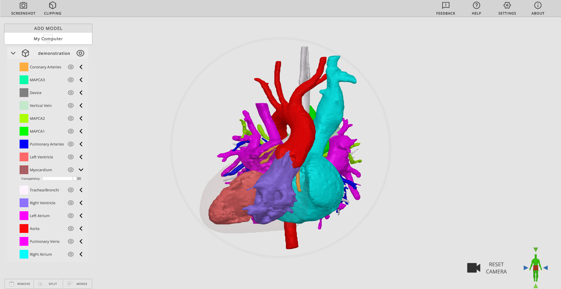 Rady’s Children’s Hospital  screenshot of heart