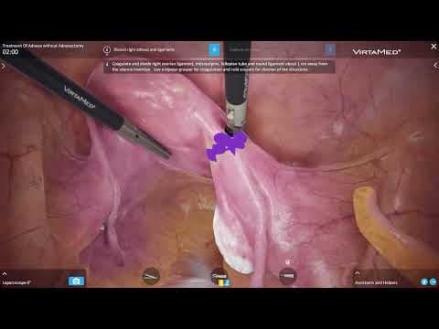 Treatment of Adnexa without Adnexectomy