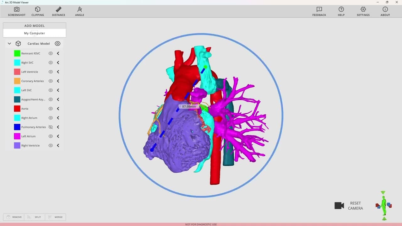 Rady Children's Arc Viewer (Lite)